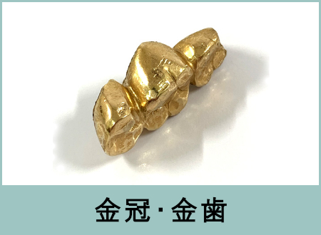 金冠・金歯(ゴールドクラウン)