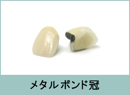 メタルボンド冠(メタボン)